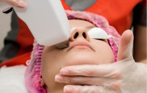 A woman undergoing IPL therapy to help treat her dry eye