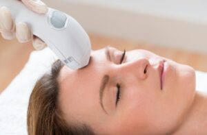 A woman receiving IPL treatment for her skin