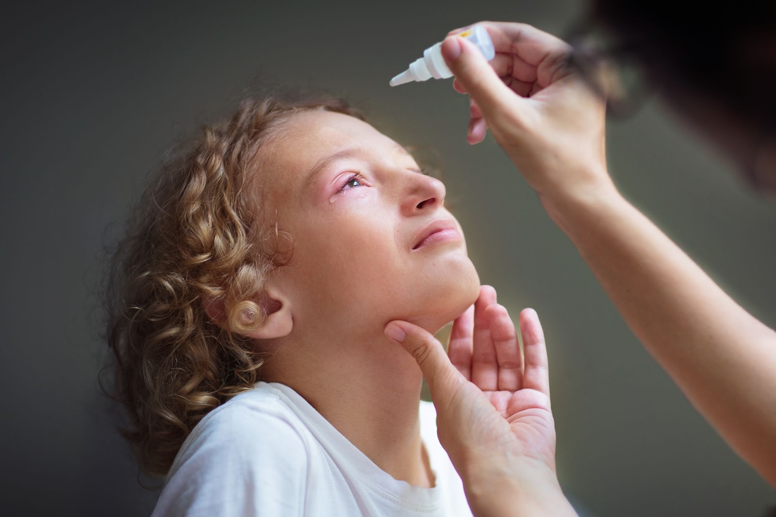 Close up of a child with swollen pink eye and an adult is putting eye drops into the child's eye.