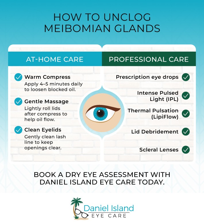 Infographic explaining how to unclog meibomian glands